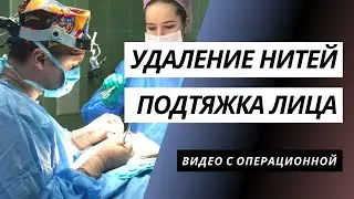 УДАЛЕНИЕ НИТЕЙ | SMAS ПОДТЯЖКА НИЖНИХ 2/3 ЛИЦА И ШЕИ | СУБМЕНТАЛЬНАЯ ПЛАСТИКА | БЛЕФАРОПЛАСТИКА