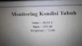 NodeMCU ESP8266 12E MONITORING Multiple ADC TEMPERATURE using webserver
