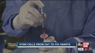 Heart Stem Cells