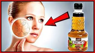 ЯБЛОЧНЫЙ уксус от пигментных ПЯТЕН и веснушек. Пять ЭФФЕКТИВНЫХ рецептов.