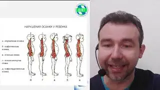 Сутулость  Тейпирование детей