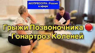 Грыжи Позвоночника 🔴 Гонартроз Коленей «АКУПРЕССУРА - Россия» в эфире #шея #поясница #акупрессура