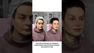 Авторская методика безоперационного омоложения позволит добиться эффекта всего за 1 визит в клинику!