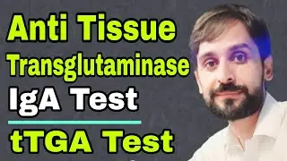 Anti Tissue Transglutaminase IgA Test | tTGA Test | MLT Hub with kamran