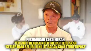 KOKO MERAH 