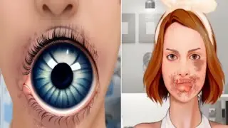 ASMR Removal Big Acne & Maggot Infected Dirty Lips| Severely Injured Animation