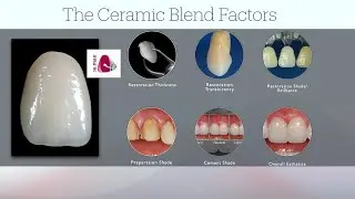 Choosing and Blending Dental Ceramics