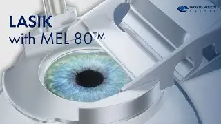 LASIK with MEL 80™