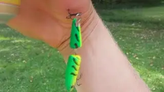 Removing Fish Hook From Hand