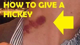 how to give a hickey leaving a mark easy