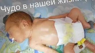 Отошли воды в 27 недель. Роды в 29 недель. Чудо в нашей жизни (3)