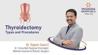 Thyroidectomy: Types and Procedures Explained | Yashoda Hospitals  | Yashoda Hospitals Hyderabad