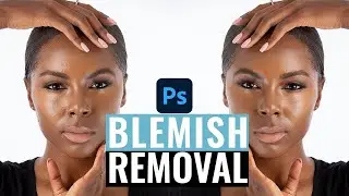 Blemish Removal - Skin Retouching Photoshop Tutorial
