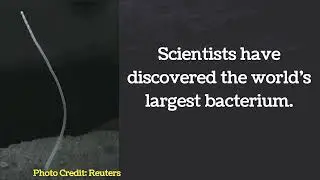 World largest bacteria discovered | Thiomargarita magnifica