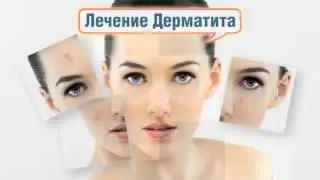 себорейный дерматит лечение мазь
