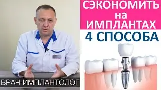 Как сэкономить на зубных имплантах! Дешевые и дорогие импланты, сэкономить на имплантации зубов