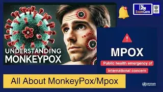 All About MonkeyPox/Mpox As WHO declared Mpox as a Public Health Emergency of International Concern.