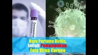 Baru Pertama Dirilis, Inilah Foto-foto Penampakan  Virus Corona