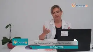 Diş Kaplamasının Ömrü Ne Kadardır?