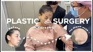 I GOT A NOSE JOB IN KOREA 🇰🇷 plastic surgery vlog (INDO SUB) | Erna Limdaugh