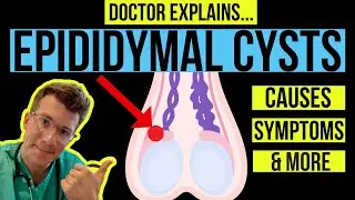 Doctor explains TESTICULAR LUMPS: PART 1 - EPIDIDYMAL CYSTS (causes, symptoms and treatments)