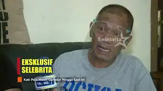 Eksklusif! Kondisi Terkini Polo 'SRIMULAT' Pasca Koma 8 Hari | Selebrita Siang 10/08/20