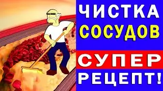 Чистка Сосудов – Супер Эффективный Народный Рецепт | Полезные Советы для Жизни