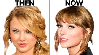 Taylor Swift NEW FACE | Plastic Surgery Analysis