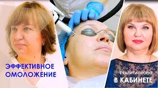 Эффективное омоложение. РекоСМА: эффективное омоложение кожи лица без операции