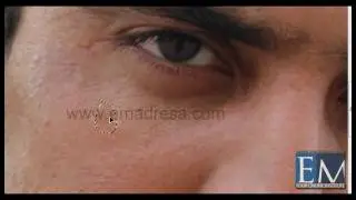 Clean your face with photoshop ( Photoshop Black belt training course with asim javed )