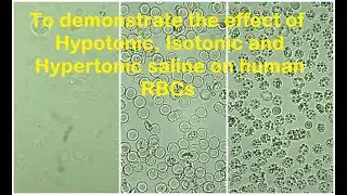 RBCs in Hypotonic, Isotonic and Hypertonic solution Practical Lab