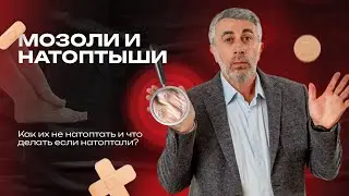 Мозоли и натоптыши. Как их не натоптать и что делать если натоптали?