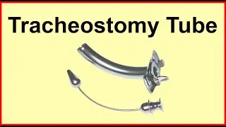 Tracheostomy tube | Trach cannula | Trach Care | Tube Metal tube de trachéotomie |