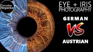 Eye and Iris Photography Tutorial | German VS. Austrian Photographer