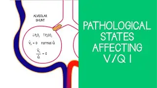 3.4 Respiratory: Pathological States affecting V/Q, Part 1