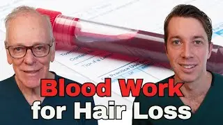 Blood Work to Check if You Have Hair Loss