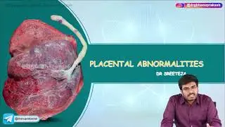 Placental Abnormalities : Obstetrics and Gynaecology Lecture