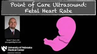 Measuring Fetal Heart Rate with M-Mode