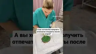 ОТПЕЧАТОК ПЛАЦЕНТЫ #акушерка #акушерствоклуб #родысдоулой #родыбезболи #мягкиероды #партнерскиероды