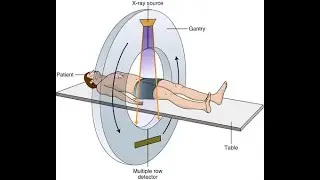 How CT Scan Machine Works