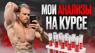 Анализы на курсе. Что нужно смотреть? Густота, липидный профиль и т.д.