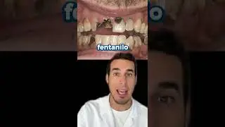 FENTANILO EFECTOS en los DIENTES - Así afecta su consumo