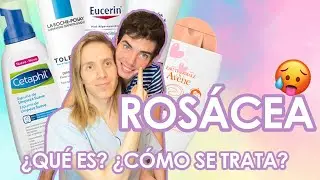 ¿Qué es la ROSACEA? ¿Cómo se trata? + Productos que recomiendo