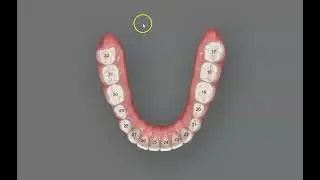 Dental Universal Numbering System - Learn to Count Teeth!