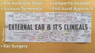 External Ear - 2, Auricle ( Lempert's Incision, Incisura Terminalis, Pre Auricular Cyst ) | TCML