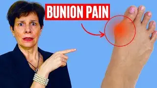 10 Easy Exercises For BUNION PAIN Relief: Women Over 50