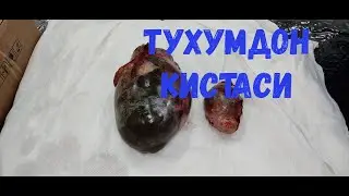 Тухумдон кистаси.