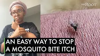 Mosquito Bite? Heres A Black Hack Thatll Stop the Itch