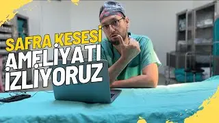 SAFRA KESESİ AMELİYATI DETAYLI ANLATIM YORUMLAMA