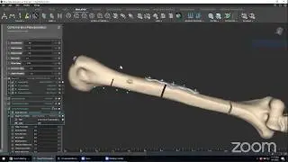 nTop Live: Accelerated Design of Patient-Specific Implants